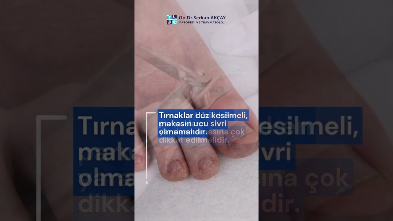 Diyabetik Ayak Tedavisinde Bilmeniz Gerekenler | Sağlıklı Ayaklar İçin Öneriler